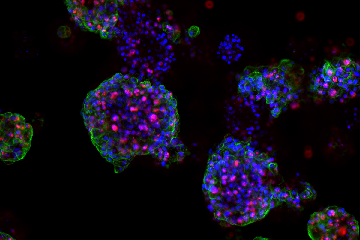 Wuchernde Prostatakrebs-Organoide: Tumor-Rezeptoren (grün), sich teilende Zellen (rot) und DNA in den Zellkernen (blau) © Marianna Kruithof-de Julio und Marta De Menna.