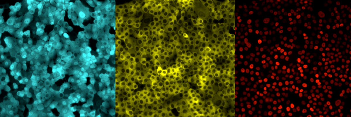 Zellpopulation, die mit dem optogenetischen Verfahren aktiviert wurde. © Pertzlab