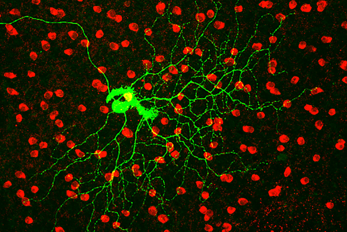 Auf Licht reagierende Ganglionzelle in einer therapierten blinden Netzhaut der Maus. © zvg