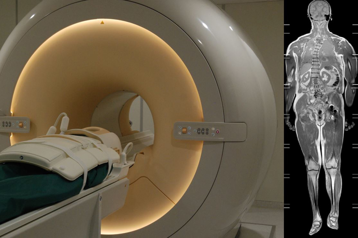 Postmortale Magnetresonanztomographie. © Institut für Rechtsmedizin, Universität Bern