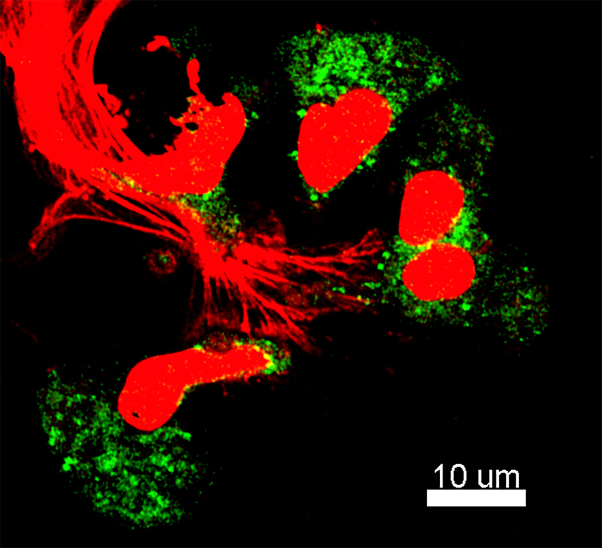 Von Hans-Uwe Simon entdeckt: Eosinophile können DNA-«Fangnetze» (rot) ausschleudern, um Bakterien unschädlich zu machen. Bild: zvg