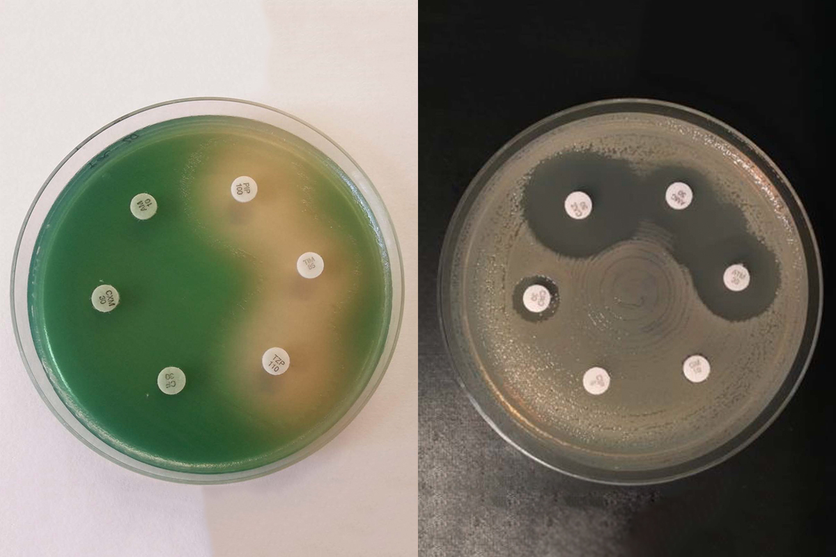 Bakterien werden auf einem Nährboden kultiviert und es wird untersucht, gegenüber welchen Antibiotika diese empfindlich sind (klarer Bereich). Links Pseudomonas aeruginosa, rechts Escherichia coli. Bilder: Institut für Infektionskrankheiten, Universität Bern.