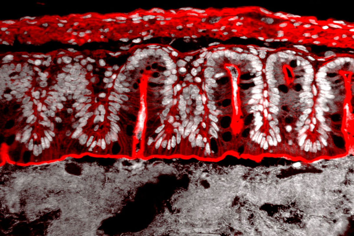 Hunderte Bakterienspezies bilden ein hochkomplexes Ökosystem direkt auf unseren Darmschleimhäuten, welches unsere Gesundheit und Interaktionen mit der Umwelt prägt. Visualisierung der Darmschleimhaut (F-Aktin: rot; Zellkerne: grau; obere Bildhälfte) und der Darmbakterien (grau, untere Bildhälfte). Fluoreszenzmikroskopie einer Darmbiopsie. Bild: Andreas Müller & Siegfried Hapfelmeier
