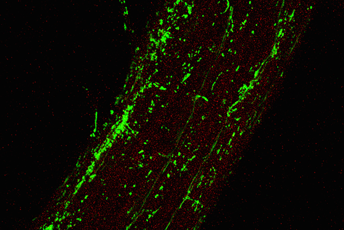 Mikroben besiedeln die Pflanzenwurzeln und beeinflussen so die Gesundheit ihrer Wirtspflanze. Die Bakteriengemeinschaft (grün) auf der Wurzel (rot) wurde mit Hilfe von Fluoreszenz-in-situ-Hybridisierung und konfokaler Mikroskopie visualisiert. Bild: Klaus Schlaeppi.
