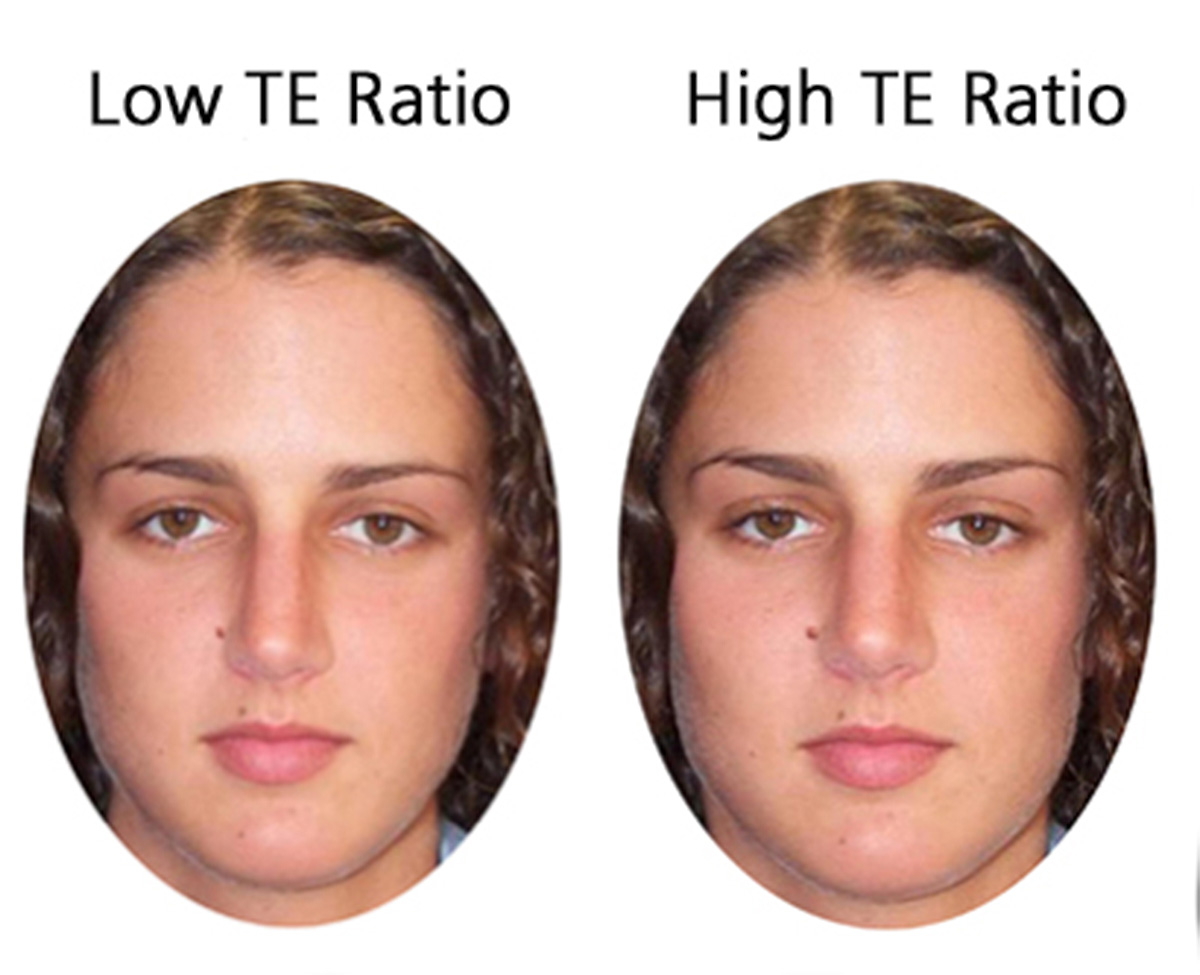 Beispiel 2: Frauen mit einem tiefen Verhältnis von Testosteron zu Östrogen (links) werden als attraktiver wahrgenommen als Frauen mit einem hohen Testosteron-Östrogen-Verhältnis (rechts).