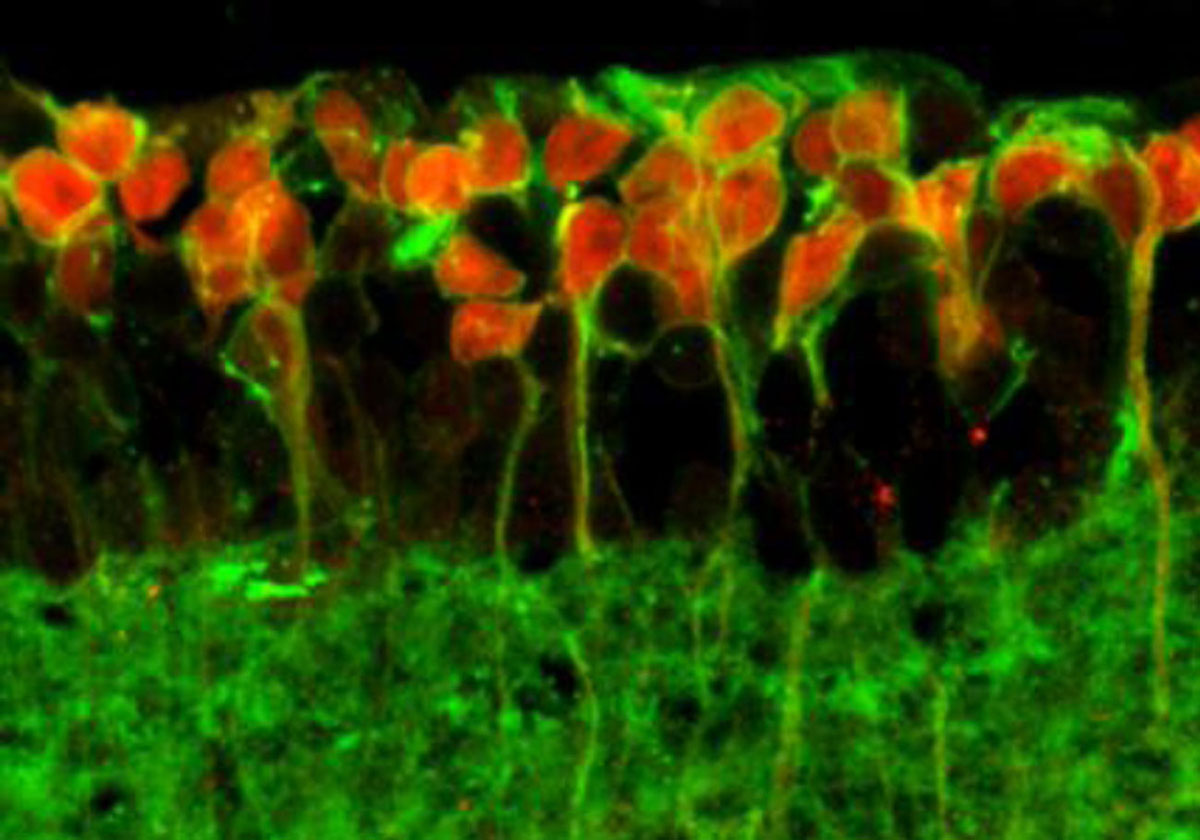 Die Netzhaut einer blinden Maus, die mit Opto-mGluR6 therapiert wurde. Die Opto-mGluR6-tragenden Zellen wurden mit einem roten Fluoreszenz-Farbstoff markiert.
