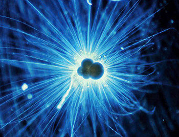 Mikroskopische Aufnahme einer Plankton-Foraminifera