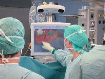 Foto eines Operationsteams, das im OP-Saal mit dem Navigationssystem arbeitet.