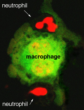 Mikroskophisches Bild einer Makrophage, die Abwehrzellen frisst