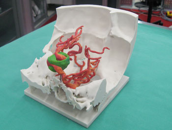 Foto eines gedruckten Gehirn-Modells ins 3-D