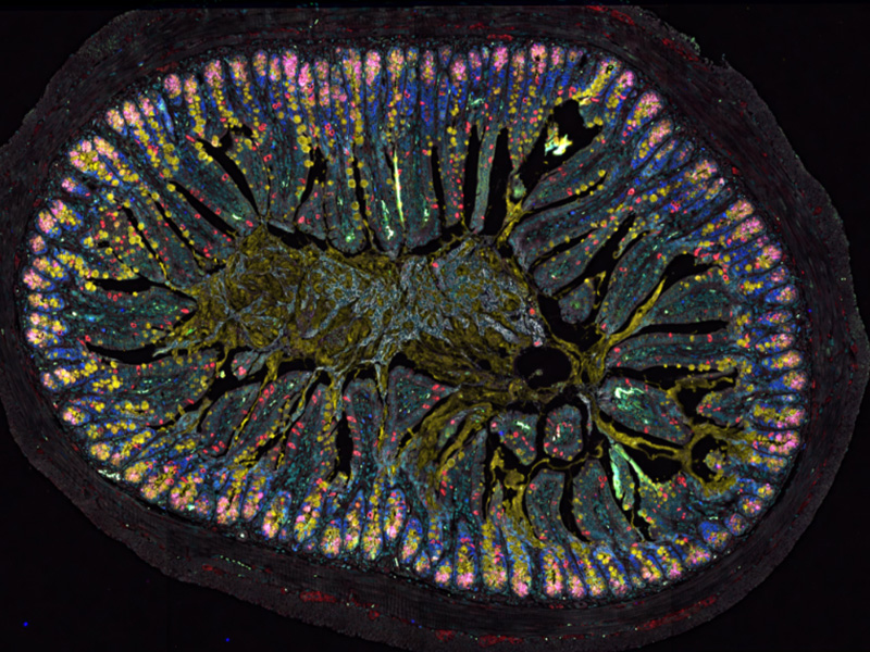 Gewebeschnitt aus dem Darm einer Maus. © Charité, Bild: Luisa Barleben